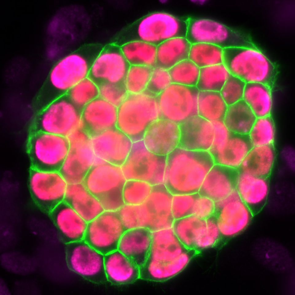 induced pluripotent stem cells applied Induced pluripotent stem cells, or ips cells, are a keystone of regenerative medicine outside the body, they can be coaxed to become many different types of cells. induced pluripotent stem cells applied Induced pluripotent stem cells, or ips cells, are a keystone of regenerative medicine outside the body, they can be coaxed to become many different types of cells.