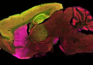 Huntington's disease and the brain