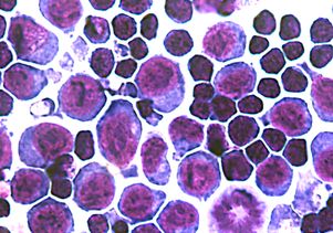 Erythroblasts