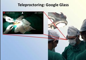 Dr. Martin Chenu from Paraguay wears Google Glass during a hernia procedure