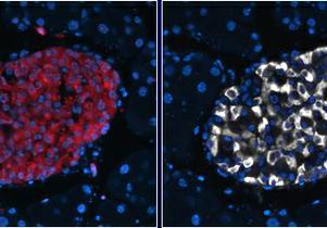 Autophagy