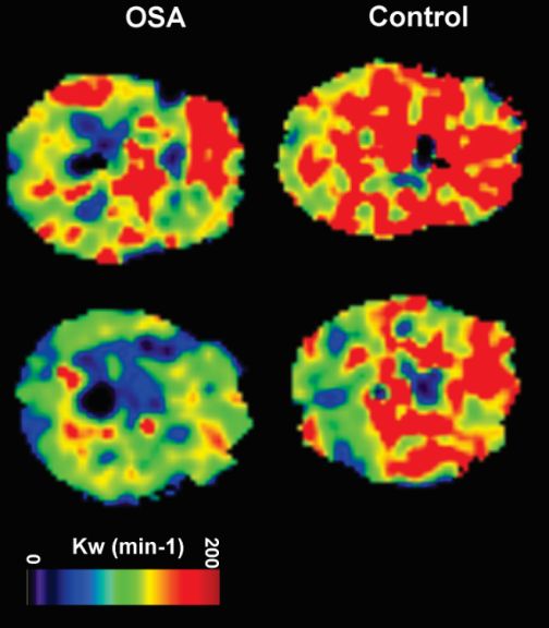 sleep control center brain