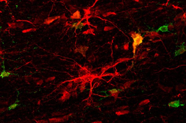 White matter