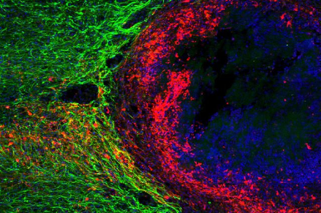 Nerve fibers regrowing