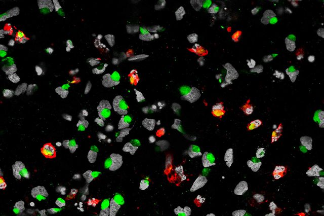 Zika virus infecting cells