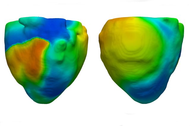 Heart model