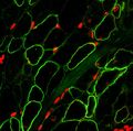 UCLA researchers create skeletal muscle from stem cells | UCLA