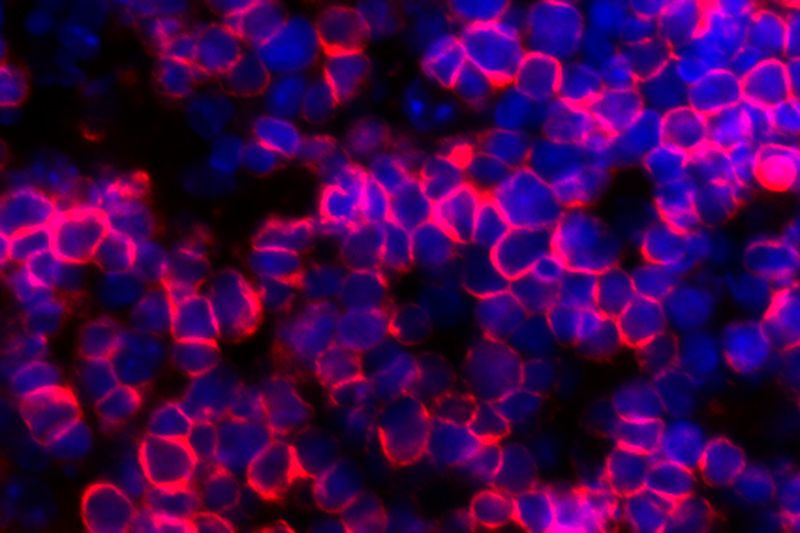 Artificial thymus developed at UCLA can produce cancerfighting T cells