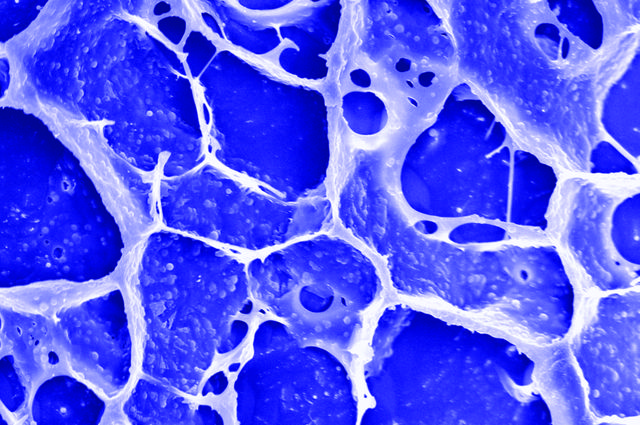 Gel particles