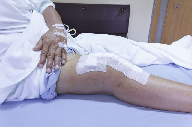 Knee surgery patient