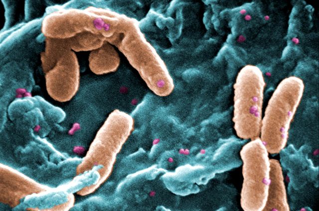 Pseudomonas aeruginosa