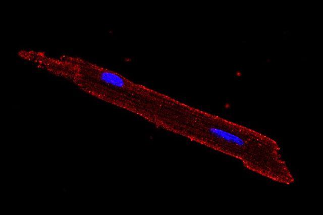 FFAR1 in heart cell