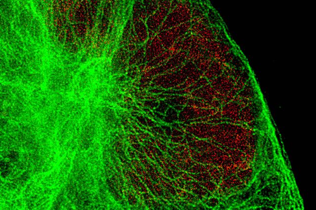 Human cell at super resolution
