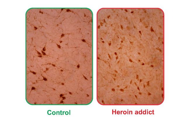 Control and heroin addiction