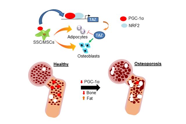 Ucla Researchers Discover Gene That Controls Bone To Fat Ratio In Bone