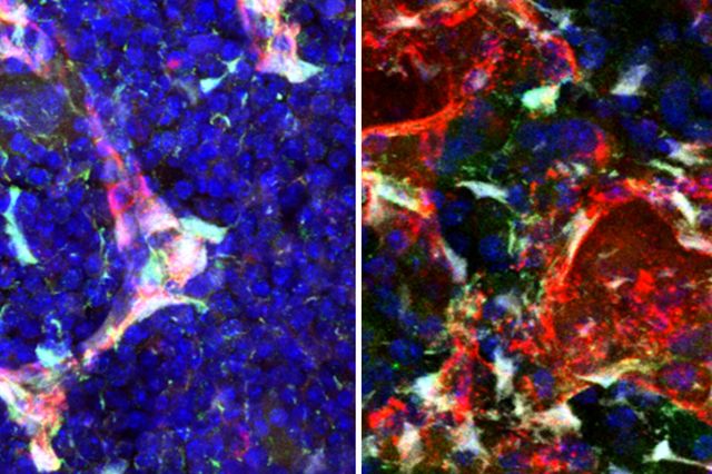 Pleiotrophin in cells