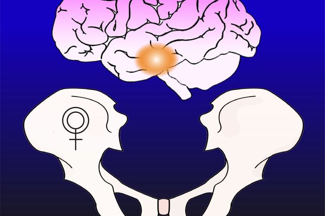 Brain and bone graphic