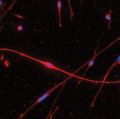 mouse schwannoma cell in culture