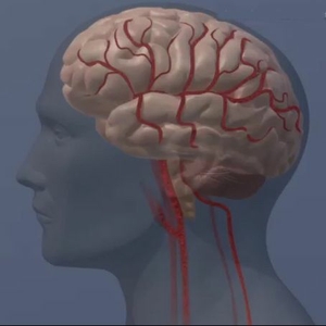 brain still