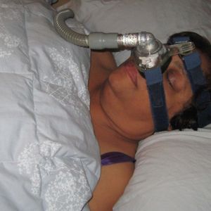 Sleep and Sleep Apnea